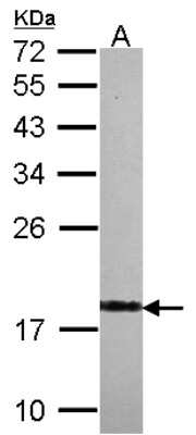 Western Blot: visinin-like 1 Antibody [NBP2-20862]