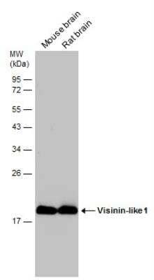 Western Blot: visinin-like 1 Antibody [NBP2-20862]