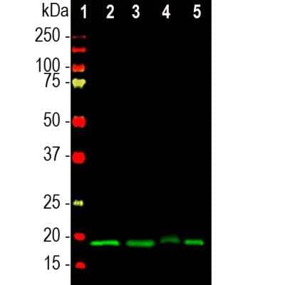 Western Blot: visinin-like 1 Antibody [NBP2-25168]