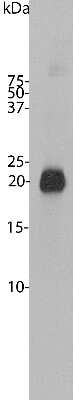 Western Blot: visinin-like 1 Antibody [NBP2-25169]