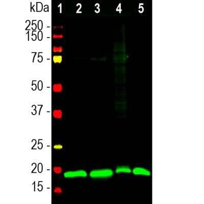 Western Blot: visinin-like 1 Antibody [NBP2-25169]