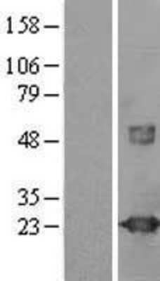 Western Blot: visinin-like 1 Overexpression Lysate [NBL1-17764]