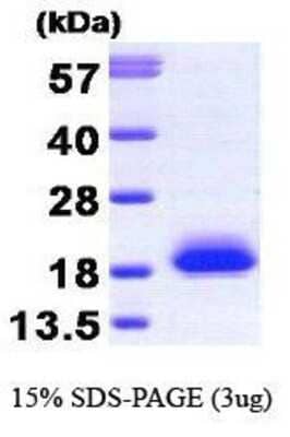 SDS-PAGE: Recombinant Human visinin-like 1 Protein [NBP1-30228]