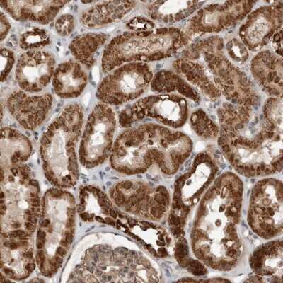 Immunohistochemistry-Paraffin: wdyhv1 Antibody [NBP1-86722]