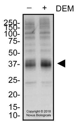 Western Blot: xCT AntibodyBSA Free [NB300-317]