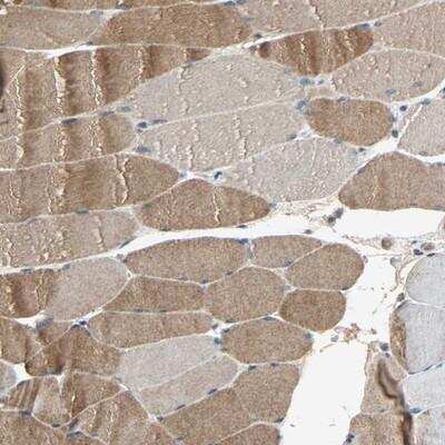 Immunohistochemistry-Paraffin: xylosyltransferase 1 Antibody [NBP1-90675]