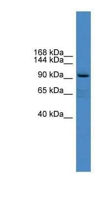 Western Blot: xylosyltransferase 1 Antibody [NBP1-91345]