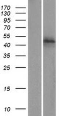 Western Blot: zfp-1 Overexpression Lysate [NBP2-05220]