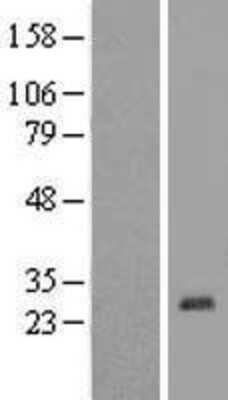 Western Blot: Zinc finger protein 581 Overexpression Lysate [NBL1-18197]