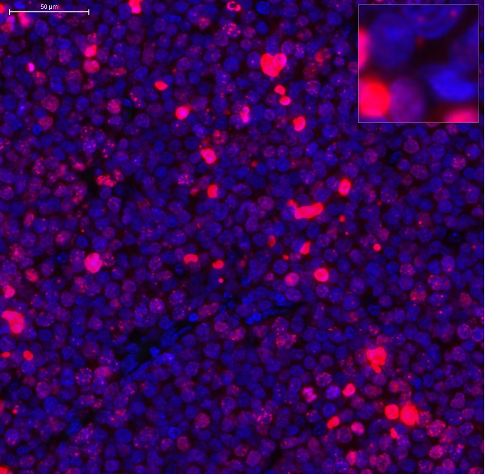 Histone H2AX [p Ser139] Antibody (NB100-2280) | Bio-Techne