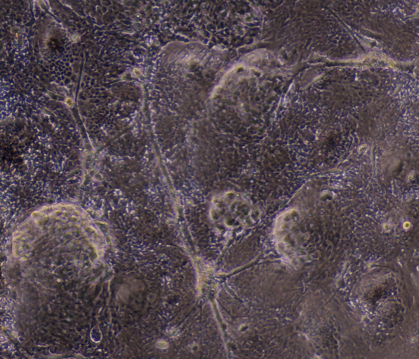 Human Wnt3a Protein (5036WN) BioTechne