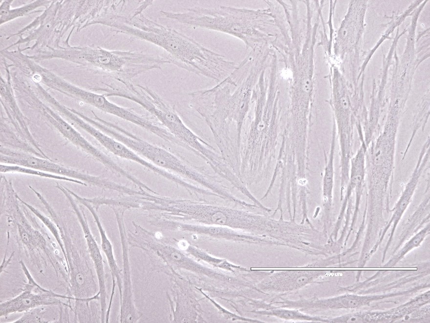 Human Wnt3a Protein (5036WN) BioTechne