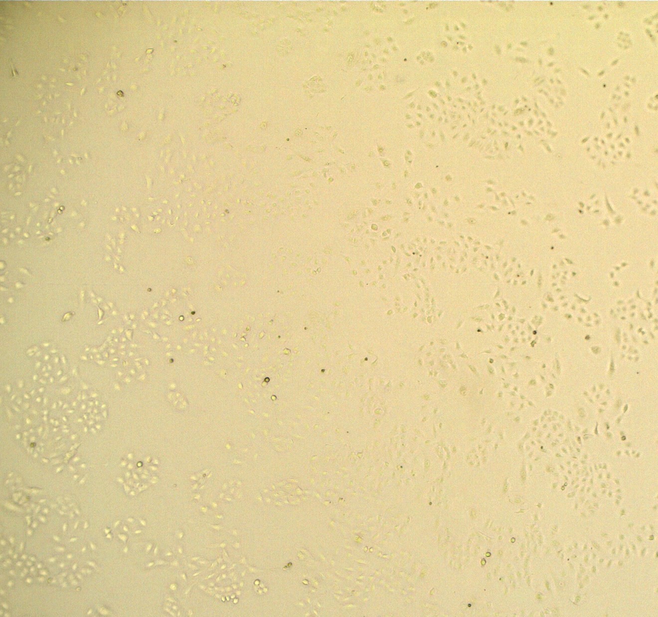 Human Noggin Protein (6057NG) BioTechne