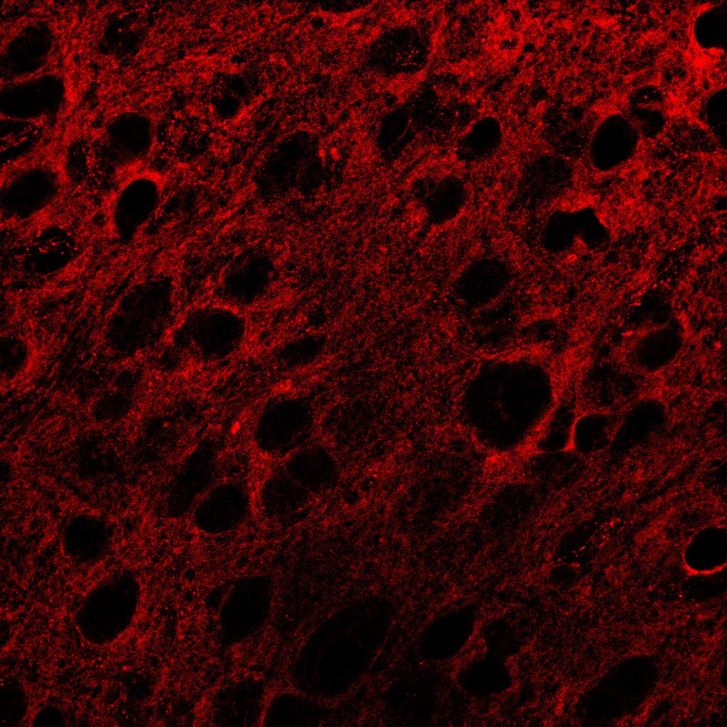 Human/Mouse/Rat TrkB Antibody (AF1494) | Bio-Techne