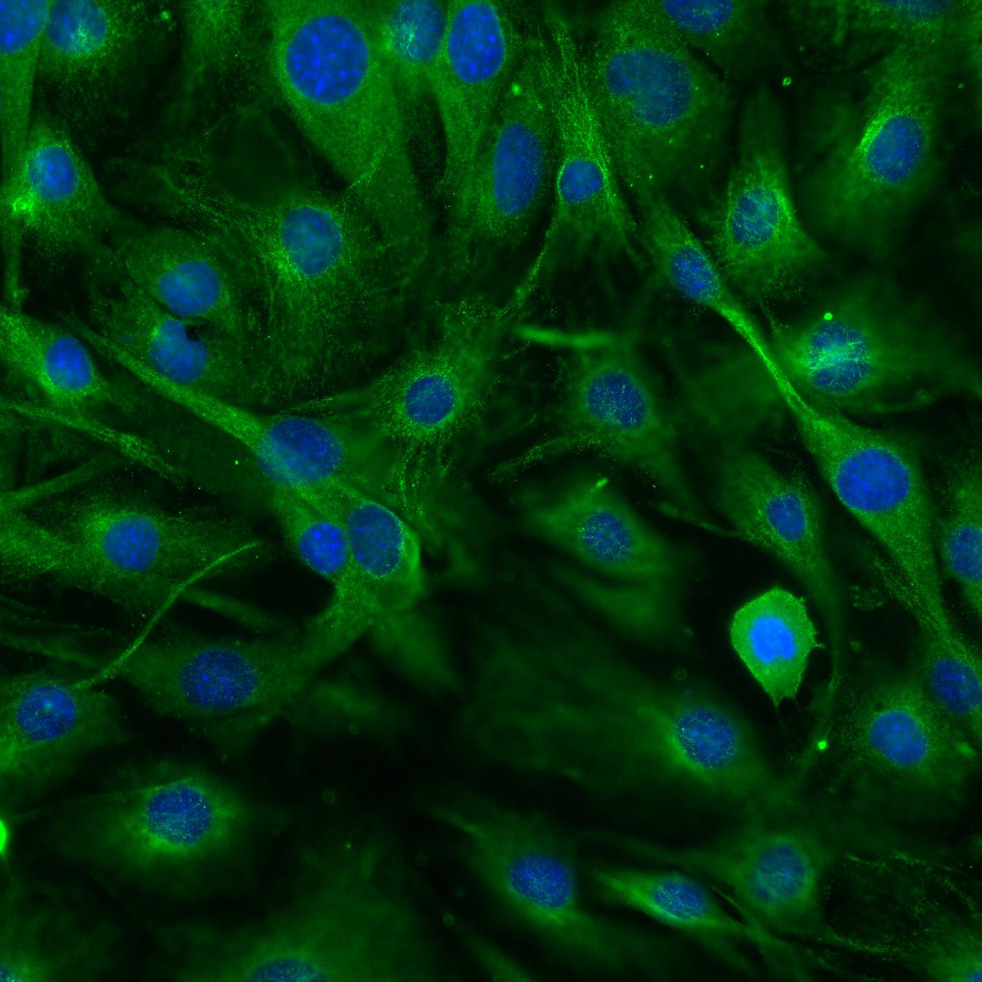 Human/Mouse/Rat Vimentin Antibody MAB2105