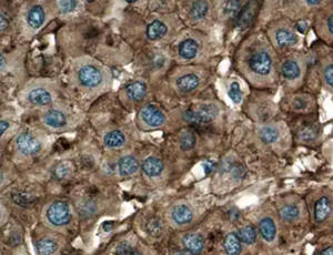 Mouse ASGR1/ASGPR1 Antibody MAB27552