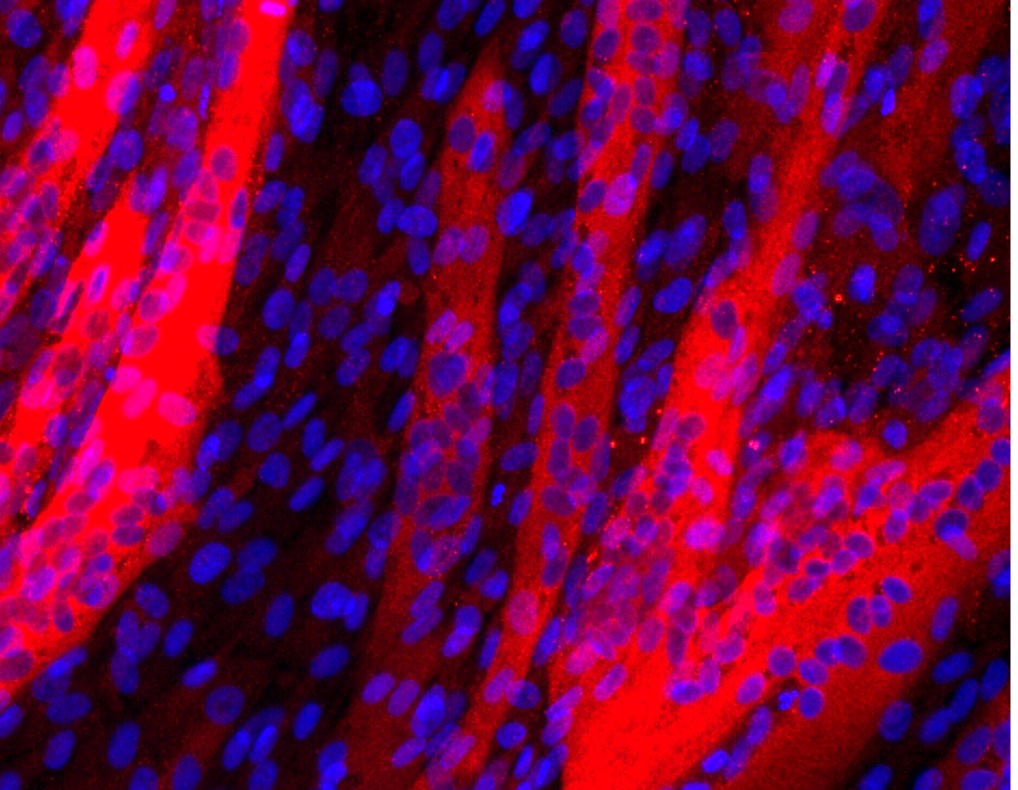 Myosin Heavy Chain Antibody (MAB4470) | Bio-Techne