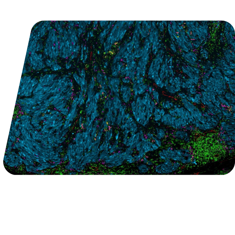 Multiplex Immunofluorescence Spatial Biology Image