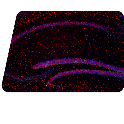 image of mir124 red stat3 green PD mouse brain